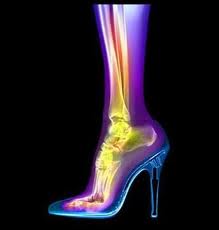 high heeled foot and leg xray